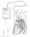 Fig. 26 - Methods and systems for the manipulation of ovarian tissues