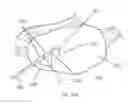 Fig. 29 - Methods and systems for the manipulation of ovarian tissues