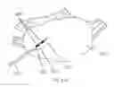 Fig. 31 - Methods and systems for the manipulation of ovarian tissues