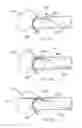 Fig. 35 - Methods and systems for the manipulation of ovarian tissues