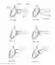Fig. 41 - Methods and systems for the manipulation of ovarian tissues