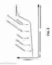 Fig. 06 - Devices and methods for treatment of heart failure by splanchnic nerve ablation