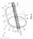 Fig. 07 - Stenosis prevention and ablation delivery system