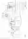 Fig. 02 - Head registration using a personalized gripper