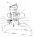 Fig. 01 - Positioning aid for surgical procedures