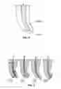 Fig. 06 - Variable heat-treat endodontic file