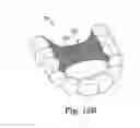 Fig. 09 - Dental appliances with shaped material components