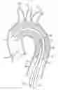 Fig. 01 - Introducer sheath with embolic protection