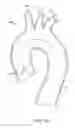 Fig. 06 - Introducer sheath with embolic protection