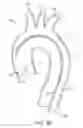Fig. 07 - Introducer sheath with embolic protection