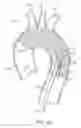 Fig. 09 - Introducer sheath with embolic protection