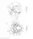 Fig. 05 - Valve prosthesis and method for delivery