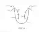 Fig. 20 - Valve prosthesis and method for delivery
