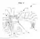 Fig. 02 - Expandable interbody implant with lateral articulation