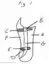 Fig. 02 - Volume Adjustable Full-Suspension Socket