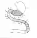 Fig. 01 - Devices and methods for modulating intestinal flow