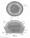 Fig. 15 - Laser eye surgery system
