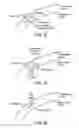 Fig. 22 - Laser eye surgery system