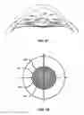 Fig. 27 - Laser eye surgery system