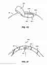Fig. 30 - Laser eye surgery system