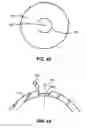 Fig. 31 - Laser eye surgery system