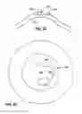 Fig. 33 - Laser eye surgery system