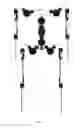 Fig. 41 - NON-INVASIVE MECHATRONIC DEVICE PROVIDING JOINT MOBILITY