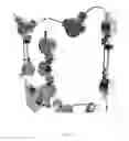 Fig. 46 - NON-INVASIVE MECHATRONIC DEVICE PROVIDING JOINT MOBILITY