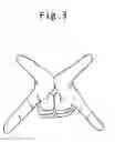 Fig. 04 - Anchored Self-Treating Trigger Point Apparatus
