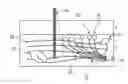 Fig. 01 - Method and system of mechanical nerve stimulation for pain relief