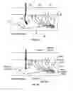 Fig. 06 - Method and system of mechanical nerve stimulation for pain relief