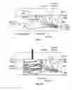 Fig. 09 - Method and system of mechanical nerve stimulation for pain relief