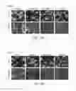 Fig. 22 - Cyclodextrin for the treatment of lysosomal storage diseases