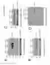 Fig. 06 - Methods and compositions for the treatment of lysosomal storage diseases