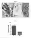 Fig. 08 - Method of treating androgen receptor negative prostate tumors and their metastases