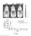 Fig. 40 - Compositions and methods for reducing the risk of post-imaging pancreatitis