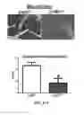 Fig. 57 - Compositions and methods for reducing the risk of post-imaging pancreatitis