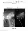 Fig. 62 - Compositions and methods for reducing the risk of post-imaging pancreatitis