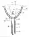 Fig. 01 - Coupling a body conduit to tissue