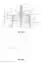 Fig. 02 - Cap Needle Assembly for an Injection Device with Predetermined Breaking Point
