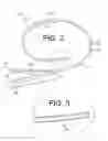 Fig. 03 - Multi-lumen indwelling catheter