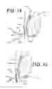 Fig. 10 - Multi-lumen indwelling catheter