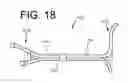 Fig. 13 - Multi-lumen indwelling catheter