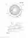 Fig. 06 - Reinforced balloon catheter
