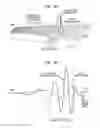 Fig. 04 - OBJECTIVE DETERMINATION OF ACOUSTIC PRESCRIPTIONS