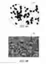 Fig. 04 - COCHLEAR IMPLANTS HAVING MRI-COMPATIBLE MAGNET APPARATUS AND ASSOCIATED METHODS