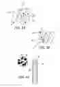 Fig. 05 - COCHLEAR IMPLANTS HAVING MRI-COMPATIBLE MAGNET APPARATUS AND ASSOCIATED METHODS