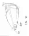 Fig. 44 - Multi-material golf club head