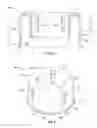Fig. 05 - Fluid flow controller and filter assembly with fluid flow controller