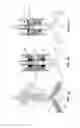 Fig. 06 - Device, system and method for the continuous processing and separation of biological fluids into components